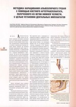 Методика наращивания альвеолярного гребня с помощью костного аутотрансплантата, полученного из ветви нижней челюсти с целью установки дентальных имплантатов