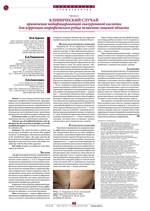 Клинический случай применения модифицированной гиалуроновой кислоты для коррекции атрофического рубца челюстно-лицевой области