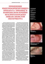 Применение иммунокорригирующего препарата "Ликопид" в комплексном лечении красного плоского лишая слизистой оболочки рта