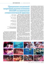 Применение секционной матричной системы компании ЗМ ESPE в клинической стоматологической практике