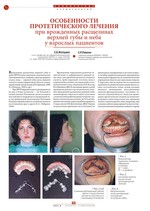 Особенности протетического лечения при врожденных расщелинах верхней губы и неба у взрослых пациентов