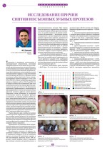 Исследование причин снятия несъемных зубных протезов