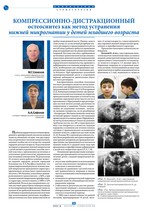 Компрессионно-дистракционный остеосинтез как метод устранения нижней микрогнатии у детей младшего возраста