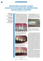 Значение освещения при определении цвета зубов в клинике