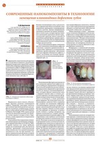 Современные нанокомпозиты в технологии замещения клиновидных дефектов зубов