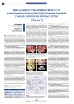 Возможности компьютерного планирования костно-реконструктивных операций у детей с патологией лицевого черепа (Часть I)