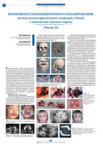 Возможности компьютерного планирования костно-реконструктивных операций у детей с патологией лицевого черепа (Часть II)