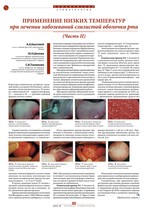 Применение низких температур при лечении заболеваний слизистой оболочки рта (Часть II)