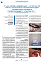 Сравнительная оценка эффективности снижения тактильной чувствительности зубов при применении зубных паст “Colgate Sensitive” и “Sensodyne F”