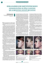 Показания для хирургического вмешательства на обеих челюстях при исправлении нижней прогнатии