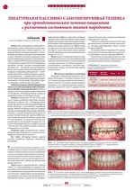 Лигатурная и пассивно-самолигирующая техника при ортодонтическом лечении пациентов с различным состоянием тканей пародонта