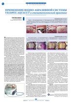 Применение водно-абразивной системы VELOPEX AQUACUT в стоматологической практике