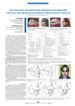Результаты экспертной оценки нарушений эстетики лица при различных формах зубочелюстных аномалий