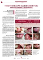 Онкологическая настороженность в практике врача-стоматолога
