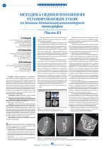 Методика оценки положения ретенированных зубов по данным дентальной компьютерной томографии