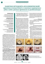 Заметки ортодонта из клинической практики лечения детей со сквозным несращением губы и неба в рамках протокола их реабилитации