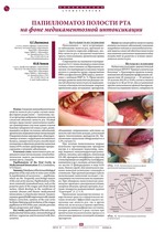 Папилломатоз полости рта на фоне медикаментозной интоксикации