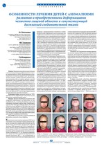Особенности лечения детей с аномалиями развития и приобретенными деформациями челюстно-лицевой области и сопутствующей дисплазией соединительной ткани