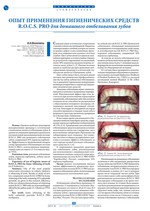 Опыт применения гигиенических средств R.O.C.S. PRO для домашнего отбеливания зубов
