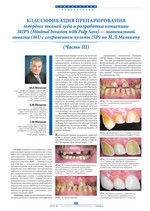 Классификация препарирования твердых тканей зуба и разработка концепции MIPS (Minimal Invasion with Pulp Save) — минимальной инвазии (MI) с сохранением пульпы (SP) по М.Л.Меликяну (Часть III)
