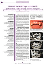 Лечение пациентов с задержкой прорезывания резцов верхней челюсти съемными ортодонтическими аппаратами (клиническое наблюдение)