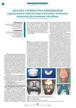 Анализ точности совмещения виртуальных моделей лица и беззубых челюстей пациента различными способами