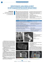 Протокол анализа КЛКТ в ортодонтической практике