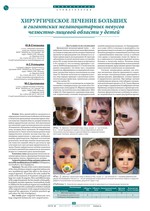 Хирургическое лечение больших и гигантских меланоцитарных невусов челюстно-лицевой области у детей