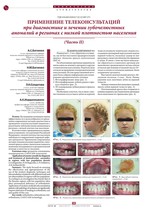 Применение телеконсультаций при диагностике и лечении зубочелюстных аномалий в регионах с низкой плотностью населения (Часть II)