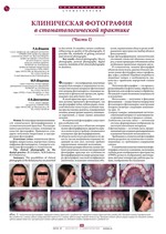 Клиническая фотография в стоматологической практике (Часть I)