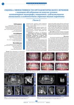 Оценка эффективности ортодонтического лечения с помощью обследования на конусно-лучевом компьютерном томографе у пациентов с зубочелюстными аномалиями и особенностями строения тканей пародонта (Часть I)