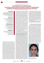 Особенности топографии лементов височно-нижнечелюстного сустава у лептопрозопов с синдромом соединительнотканной дисплазии (Часть II)
