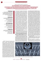 Особенности топографии элементов височно-нижнечелюстного сустава у лептопрозопов с синдромом соединительнотканной дисплазии (Часть III)