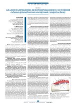 Анализ напряженно-деформированного состояния съёмных ортопедических конструкций с опорой на балку