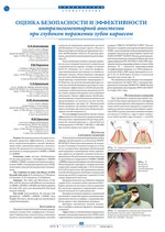Оценка безопасности и эффективности интралигаментарной анестезии при глубоком поражении зубов кариесом