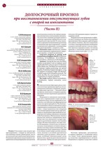 Долгосрочный прогноз при восстановлении отсутствующих зубов с опорой на имплантаты (Часть II)