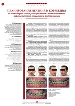 Планирование лечения и коррекция асимметрии лица у пациентов с сочетанными зубочелюстно-лицевыми аномалиями