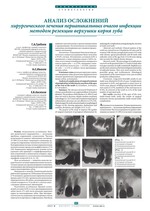 Анализ осложнений хирургического лечения периапикальных очагов инфекции методом резекции верхушки корня зуба