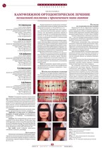 Камуфляжное ортодонтическое лечение мезиальной окклюзии с применением мини-винтов