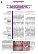 Влияние удаления комплектных зубов при лечении аномалий окклюзии на эстетику лица и параметры зубных дуг (Часть II)